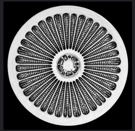 Arachnoidiscus Zeiss.jpg